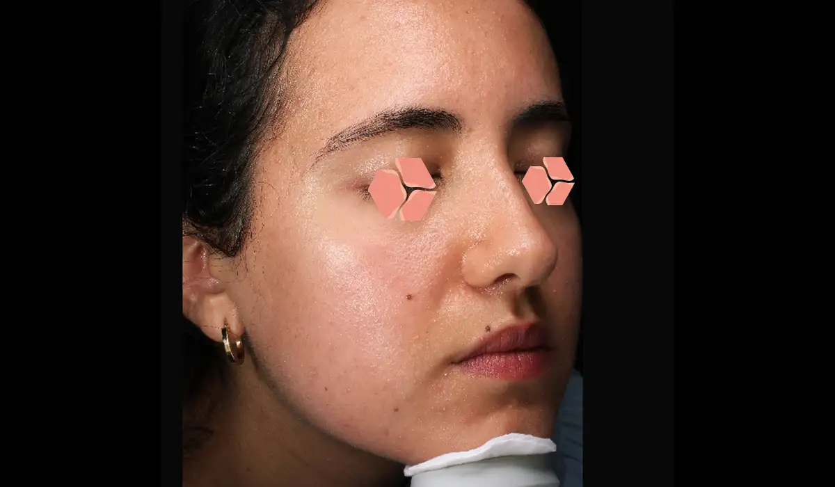 Cilt Yenileme ve Gençleştirme BA 3