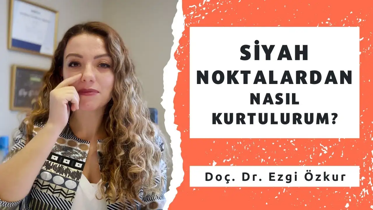 Siyah Noktalardan Nasıl Kurtulabiliriz?